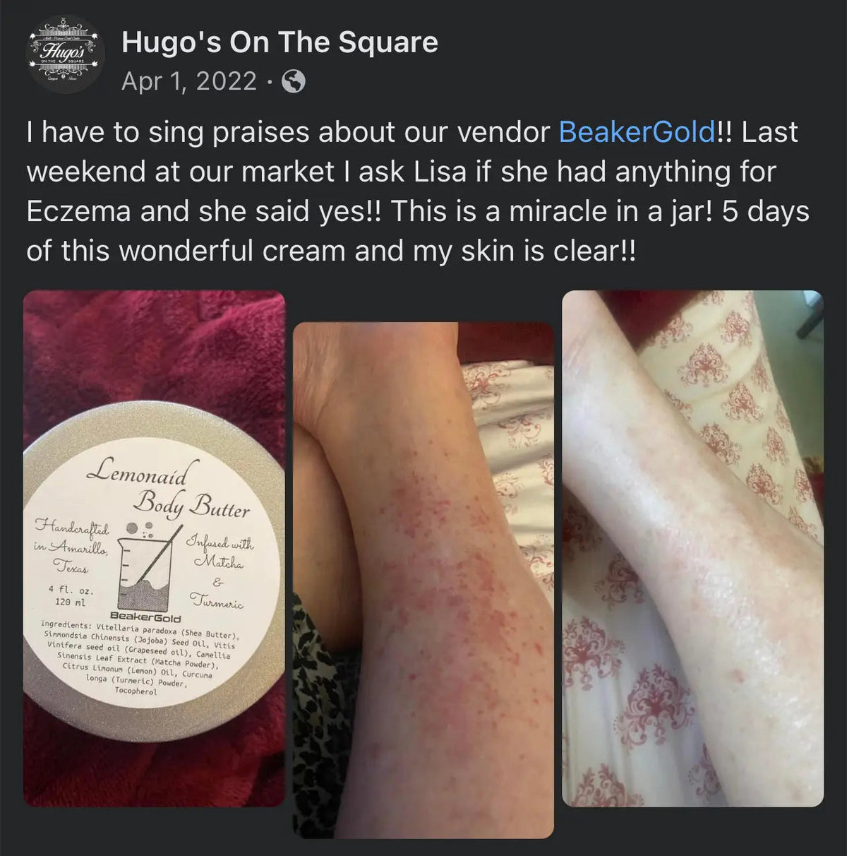 Lemonaid Organic Body Butter – Deep Relief for Severely Dry Skin