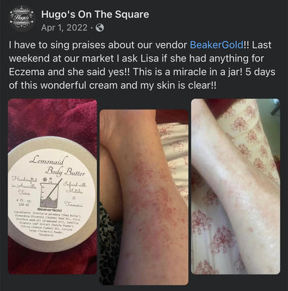 Lemonaid Organic Body Butter – Deep Relief for Severely Dry Skin